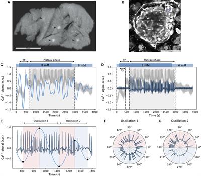 Assessing Different Temporal Scales of Calcium Dynamics in Networks of Beta Cell Populations